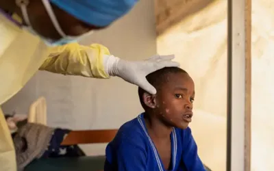 WHO grants approval for first Mpox vaccine to strengthen disease control in Africa
