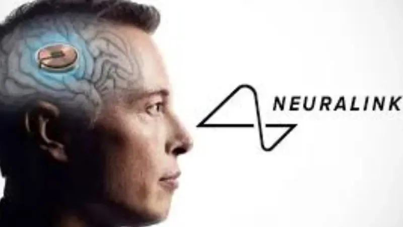 Neuralink-surgeries