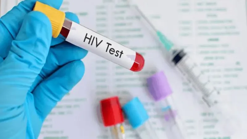 HIV