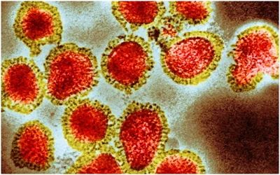 Experts warn smallpox could trigger future global pandemic