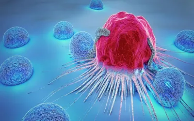 How does AI detect breast cancer? Here's what study says