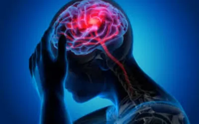 Mediterranean diet may significantly lower stroke risk in women