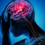 Mediterranean diet may significantly lower stroke risk in women