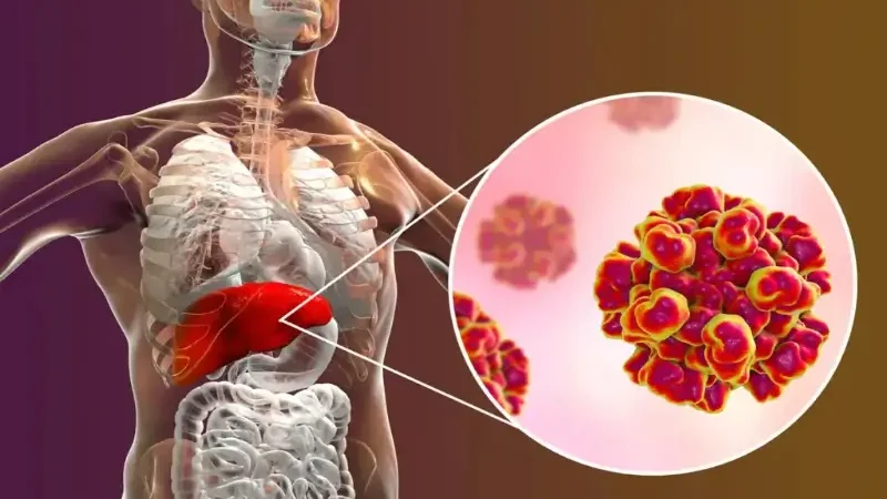 Here's all you need to know about Hepatitis