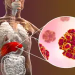 Here's all you need to know about Hepatitis