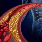 High Cholesterol: The Hidden Enemy of the Heart