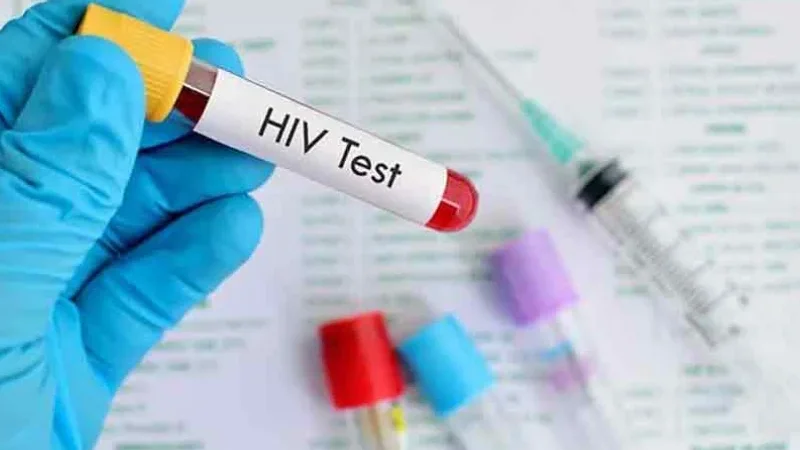 HIV screening