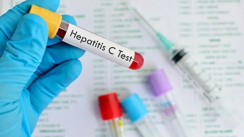 Hepatitis C