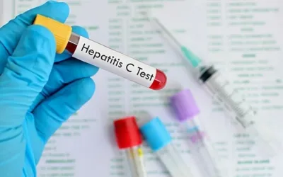 Hepatitis C free screening and treatment programme announced