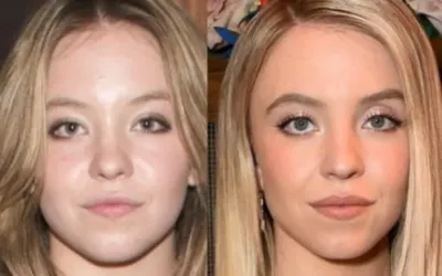 Euphoria star Sydney Sweeney speaks out against cosmetic surgery