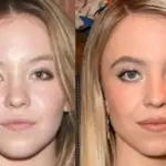 Euphoria star Sydney Sweeney speaks out against cosmetic surgery