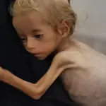 Starvation crisis in Gaza: 100 children dead amid Israel blockade