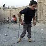 Pakistan confirms two new polio cases