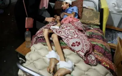 Gaza: Hunger kills 289, 15,000 awaits for medical evacuation