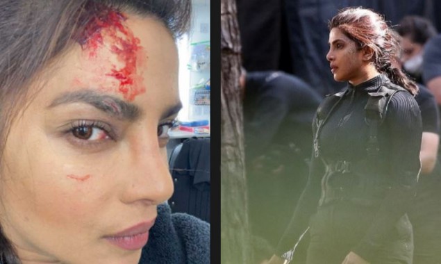 Priyanka Chopra gets injured while shooting for ‘Citadel’