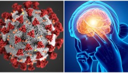 Decline in brain age observed among hospitalized COVID-19 patients: Research