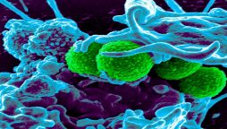 Aussie researchers develop new copper surface to help combat antibiotic-resistant superbugs