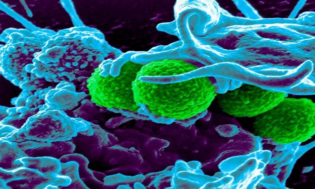 Aussie researchers develop new copper surface to help combat antibiotic-resistant superbugs
