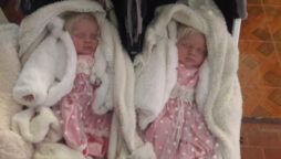 A woman gives birth to twins with snow-white hair in Argentina