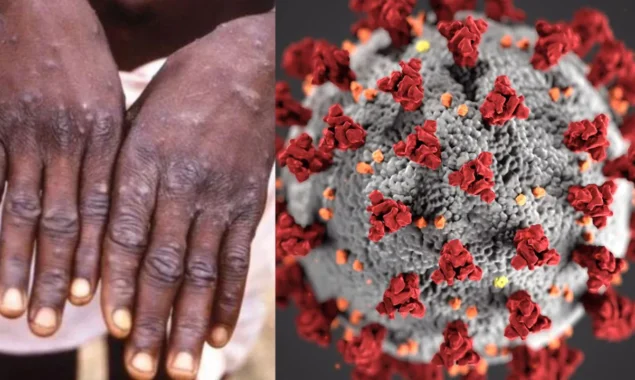 Israel reports monkeypox case as virus spreads to Middle East