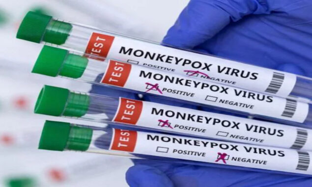 Monkeypox cases around the world