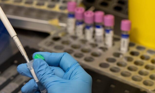 San Francisco declares state of emergency as virus cases rise