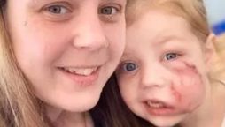 XL Bully Dog Attack Leaves Girl with Lifetime Scar