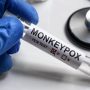 KP confirms third Monkeypox Case
