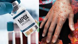 Alert; India reports first case of mpox