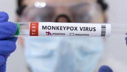 EU health agency urges Europe to prepare for more Monkey pox cases