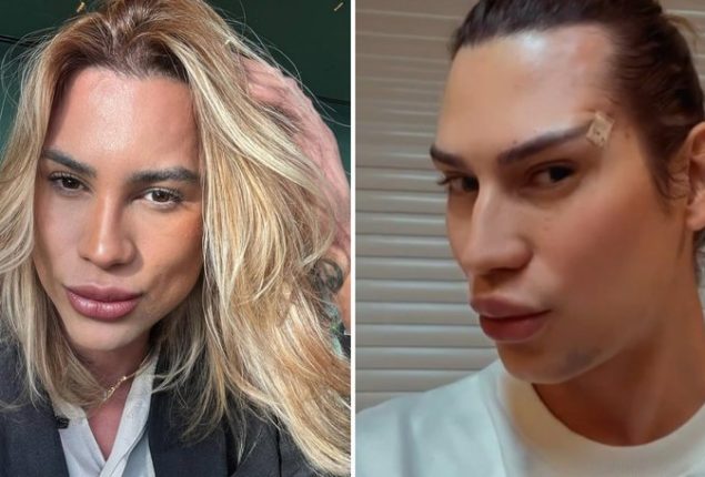 Brazilian style icon dies after ‘Fox Eyes’ surgery complications